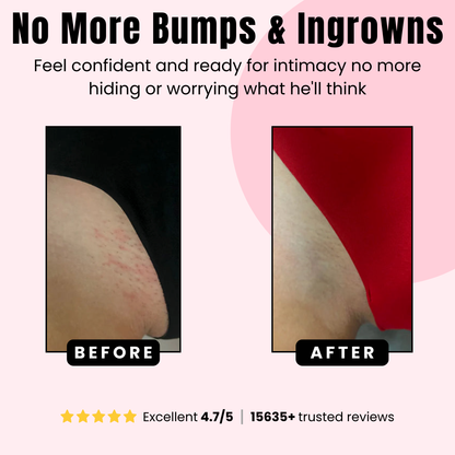 BioRecovery ingrown defense serum