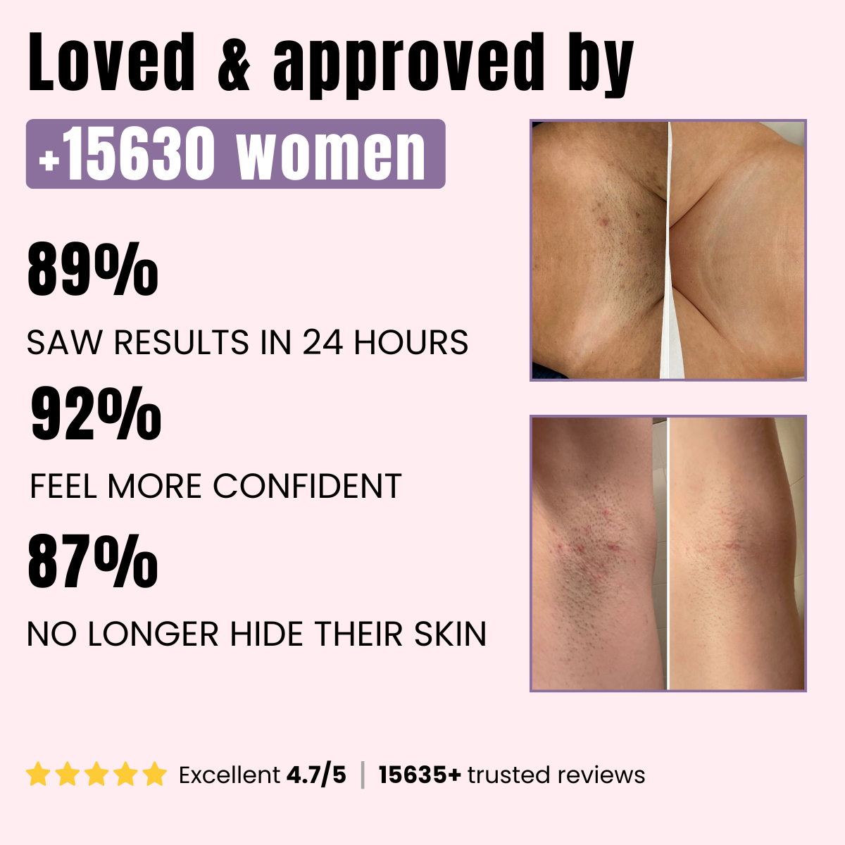 BioRecovery ingrown defense serum